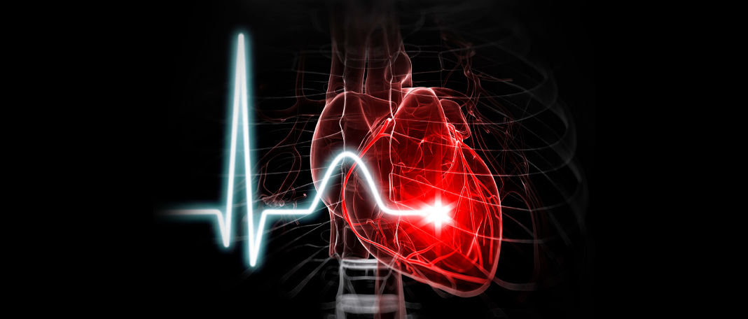 New Technology to Detect Irregular Heartbeat