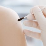 Painless Skin Swabs That Diagnose Parkinson’s