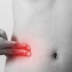 A Human Body without an Appendix
