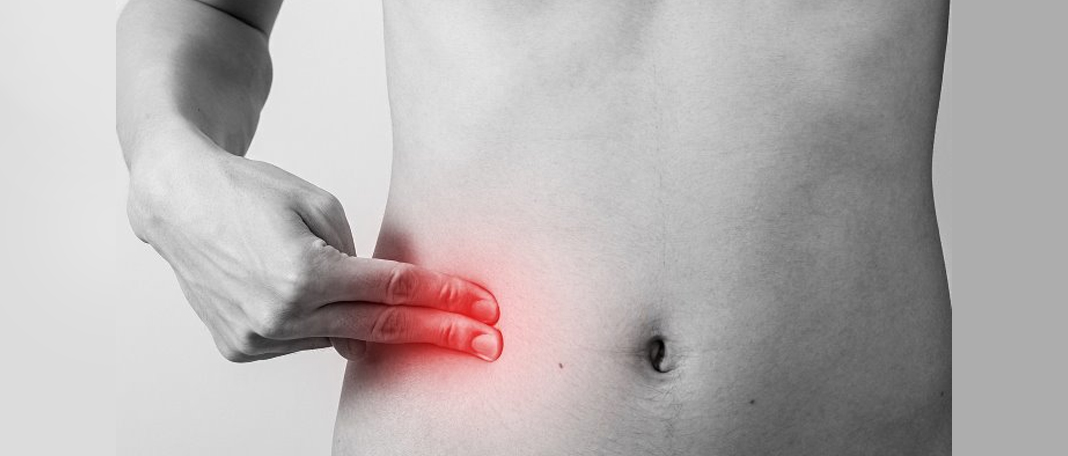 A Human Body without an Appendix