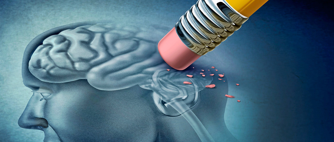 Study Shows That Playing Games Help to Prevent Alzheimer’s Disease