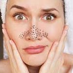 Make the Blackheads Disappear with Home-Tips