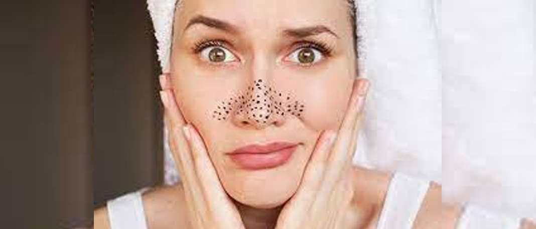 Make the Blackheads Disappear with Home-Tips