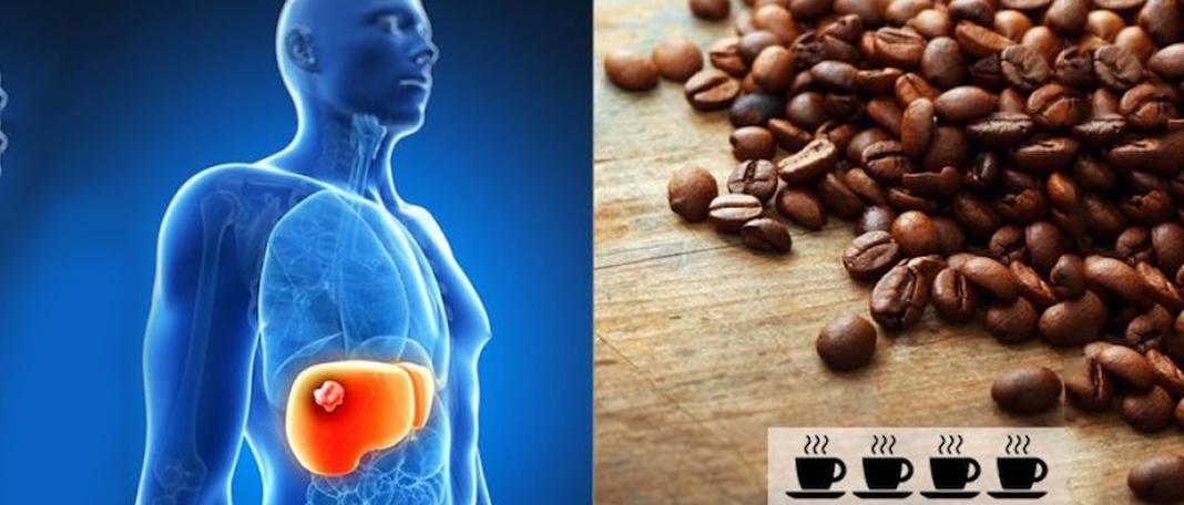 Drinking Coffee Can Protect Your Liver from Diseases