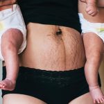 9 Changes in a Woman’s Body After Childbirth