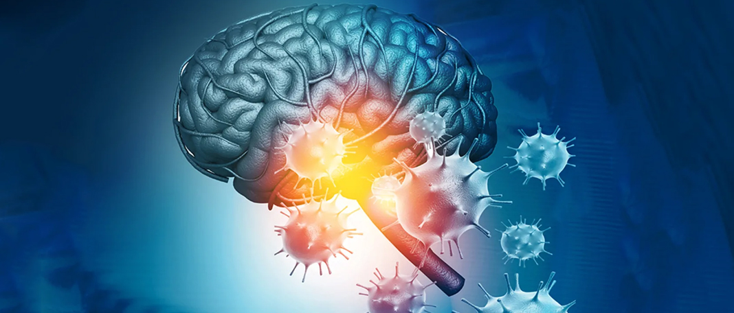 How does COVID-19 Cause Brain Inflammation?