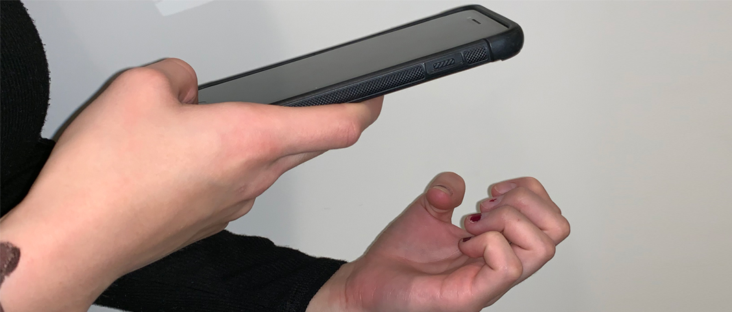 Smartphone Detects Anemia with 70% Accuracy