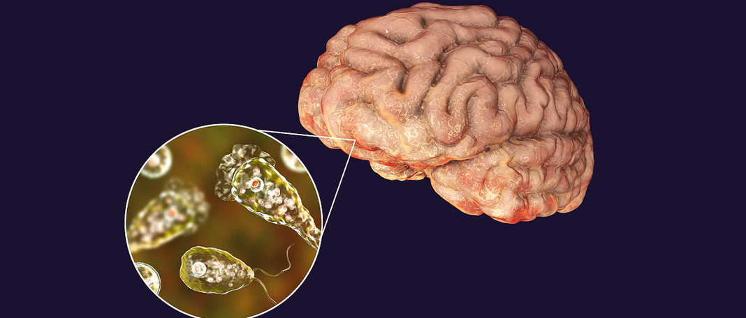 Brain-Eating Amoeba Infection Rises in the U.S.