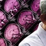 Can Age-Related Memory Loss Be Reversed?