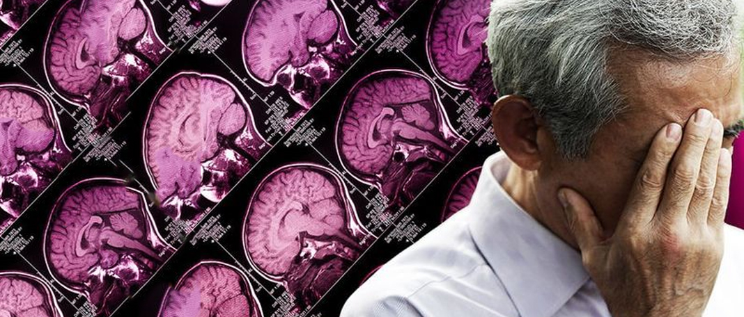 Can Age-Related Memory Loss Be Reversed?