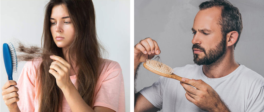 Hair Loss Cures and Do They Really Work?