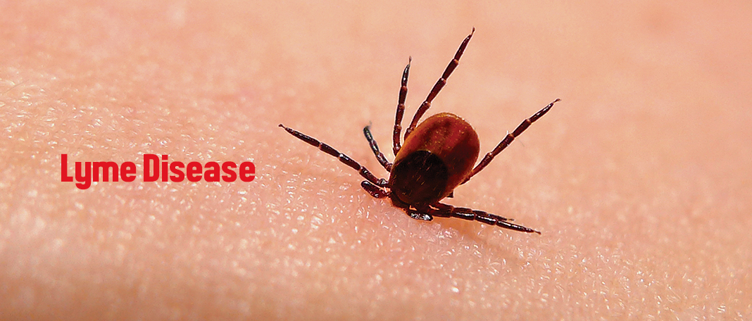 Lyme Disease Heightens the Risk of Suicidal Thoughts and Mental Illness