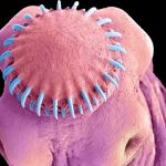 A Man with Tapeworm in Brain Suffered from Mysterious Seizures!