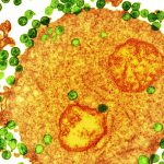 Is There a Natural Cure for HIV and AIDS?
