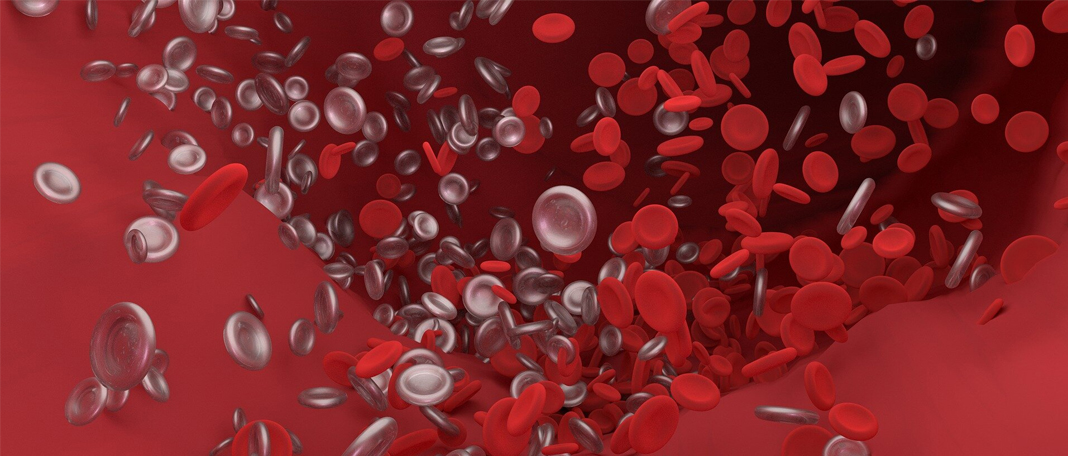 Milvexian, an Effective Oral Pill for Prevention of Venous Blood Clots
