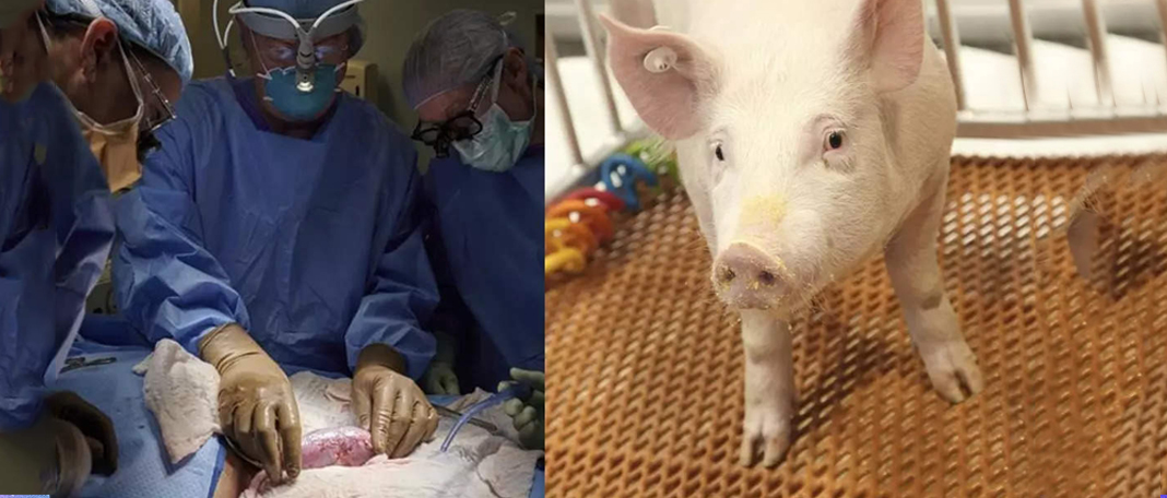 Pig Kidney Transplant to Human for the First Time