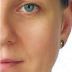 All About the Causes and Treatment of Aging