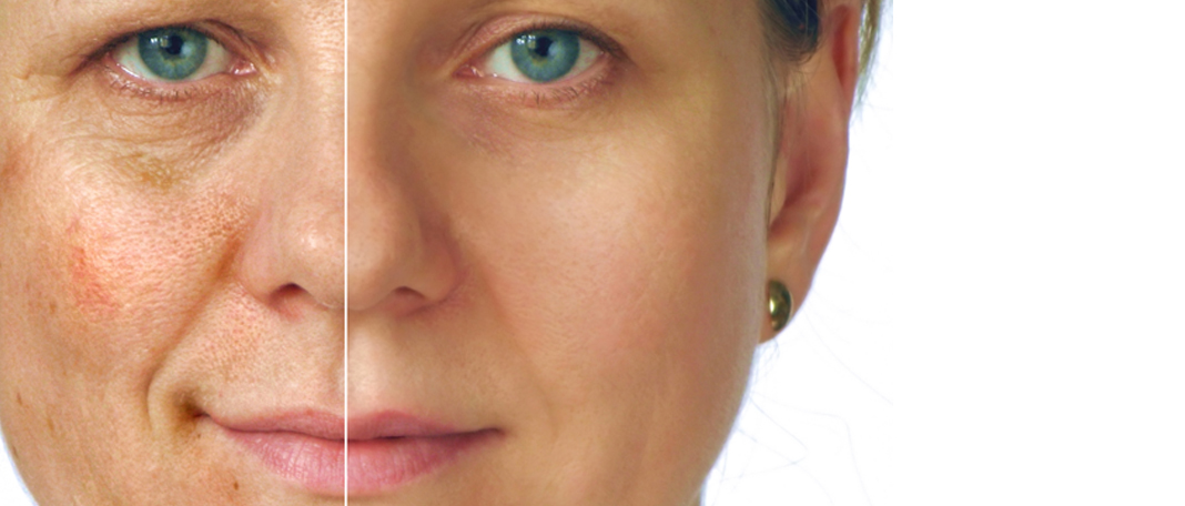 All About the Causes and Treatment of Aging