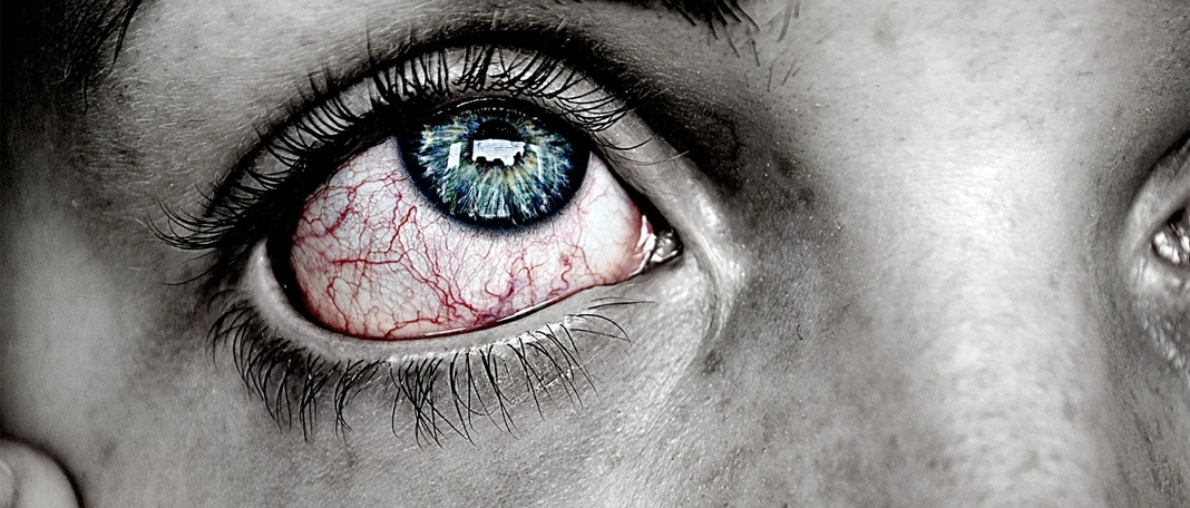 Is There a Permanent Cure for Dry Eyes?