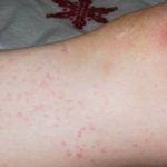 Natural Ways to Avoid Basic Allergies