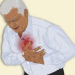 What Are the Causes of Angina and Heart Attack?
