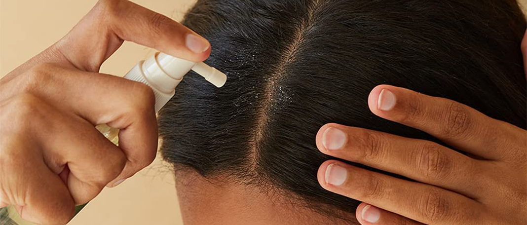 How to Protect Your Hair and Scalp from the Sun