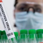 Everything You Need to Know About Monkeypox