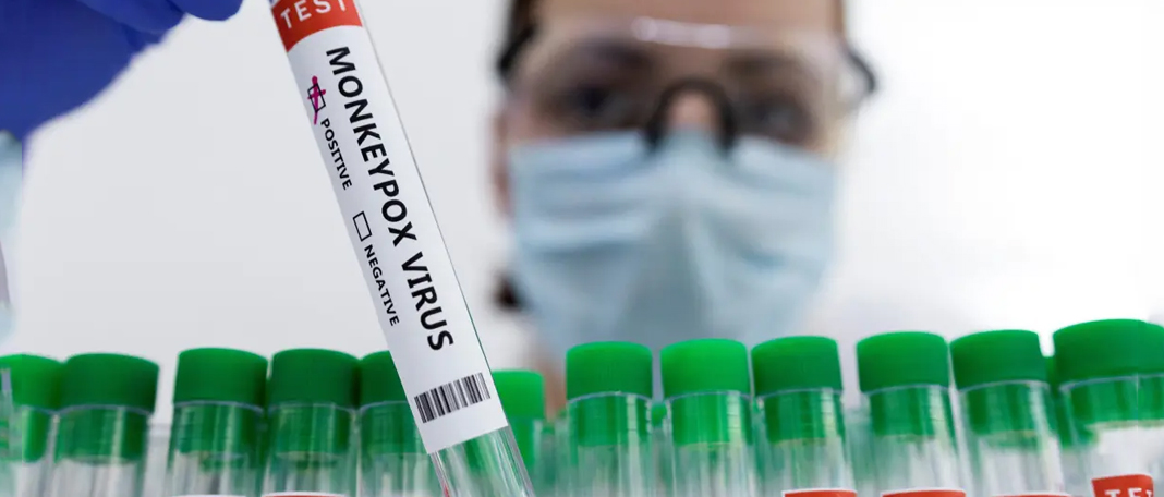Everything You Need to Know About Monkeypox