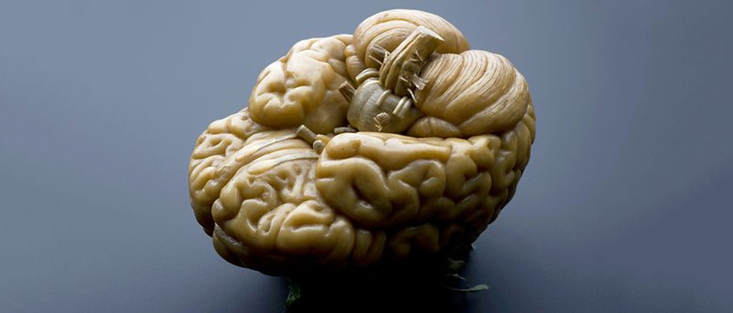 Parts of the Brain