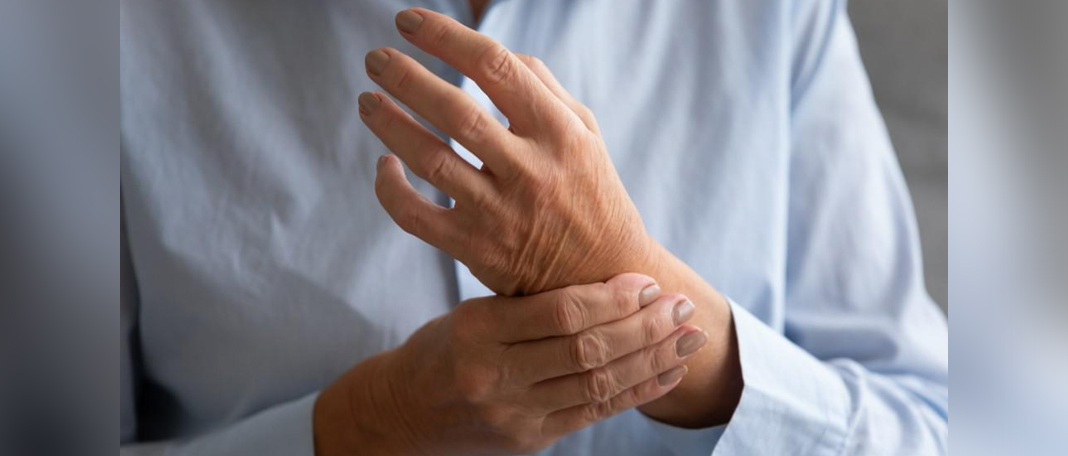 Does weight loss reduce Arthritis Impacts?