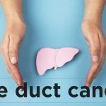 Everything You Must Know About Bile Duct Cancer