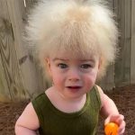 Gene Mutations can Cause your Hair Frizzy and Uncombable