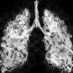 Myths and Facts Related to Lung Cancer