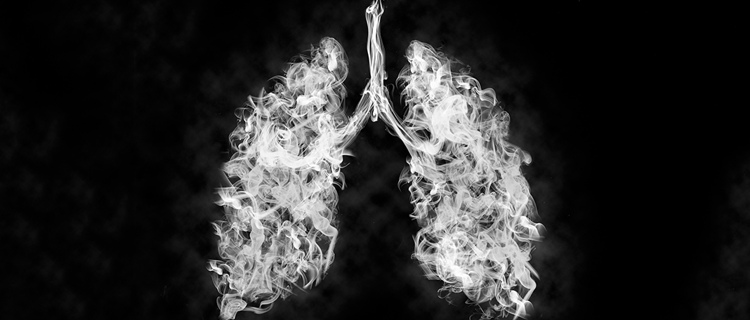 Myths and Facts Related to Lung Cancer