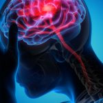 All You Need To Know About Seizures