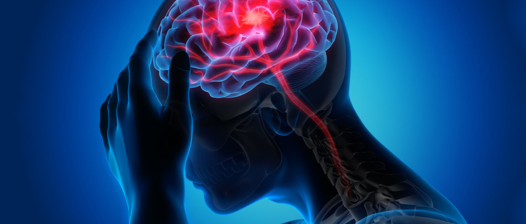 All You Need To Know About Seizures