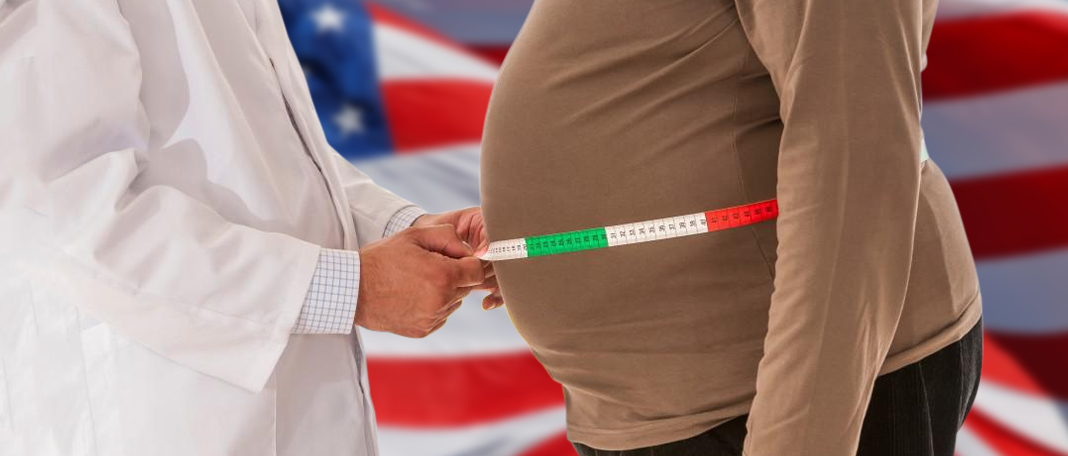 United States And Its Obesity