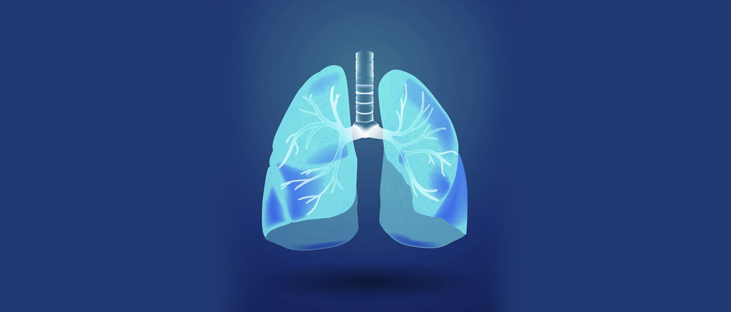 All about Lung Cancer and New AI Tool for Early Detection