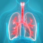 New Double Lung Transplant Technique is Successful in Late-Stage Cancer Patients