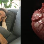 Long Daytime Naps Might Raise Your Odds for A-Fib