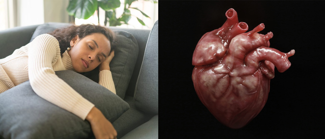 Long Daytime Naps Might Raise Your Odds for A-Fib