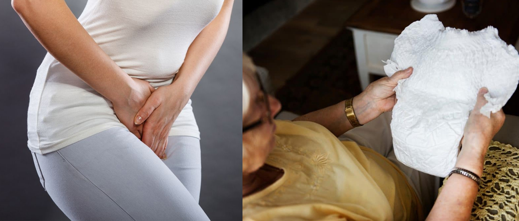 Natural Home Remedies for Incontinence
