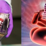 What Is the Use of Cord Blood?