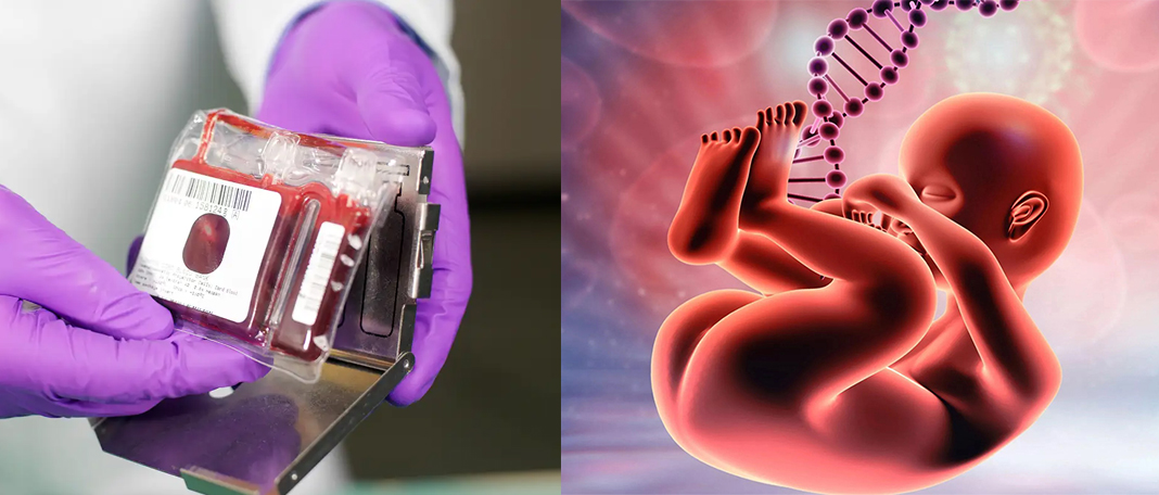 What Is the Use of Cord Blood?