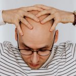 Why Do Men Go Bald? Symptoms and Causes