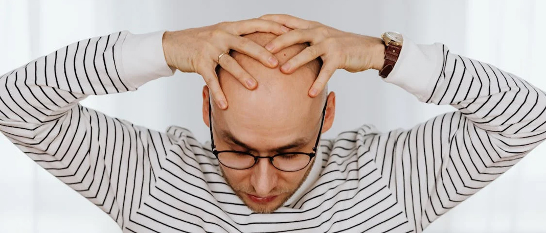 Why Do Men Go Bald? Symptoms and Causes
