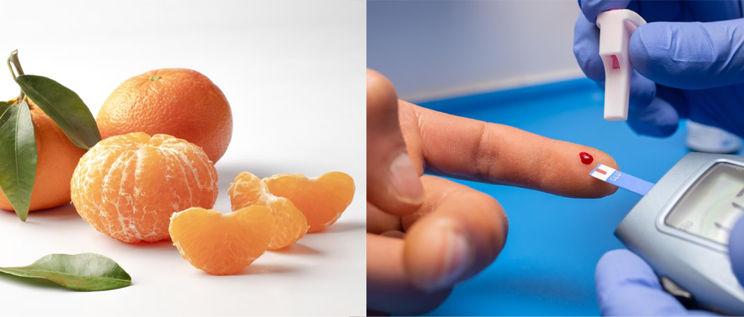 Are Oranges Beneficial for Diabetes?