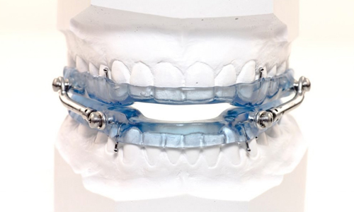 Oral-Appliances