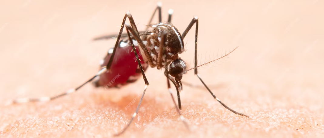 Home Remedies for Mosquito Bites