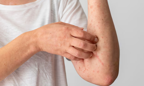 Common Symptoms